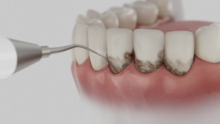 Trusted Wisdom Tooth Removal service in Rockwell, NC - Dentist Open Now